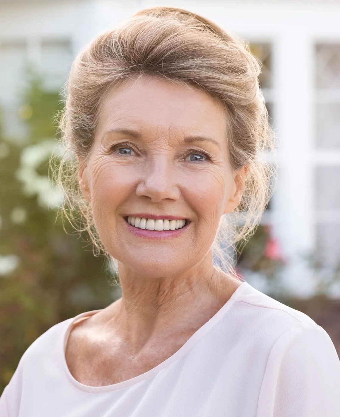 3d-guided-implant-surgery-dubai