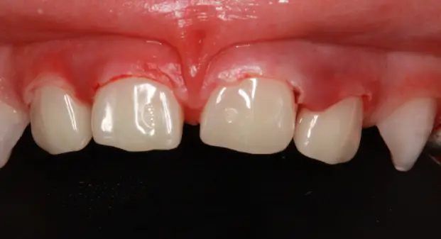 best-female-dentist-for-kids-pulpectomies-dubai