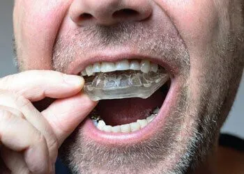 bite-guard-night-guard-cost-dubai