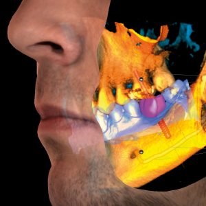 cbct-scan-cost-dubai