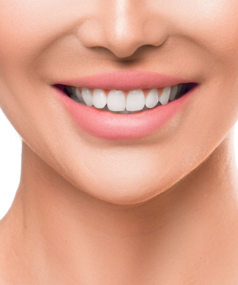 high-strength-pfm-crowns-dubai