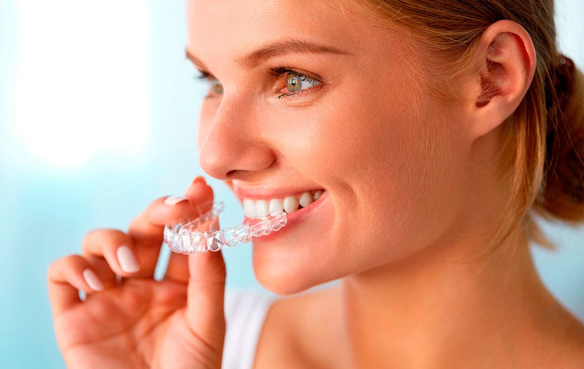 invisalign-orthodontist-dubai