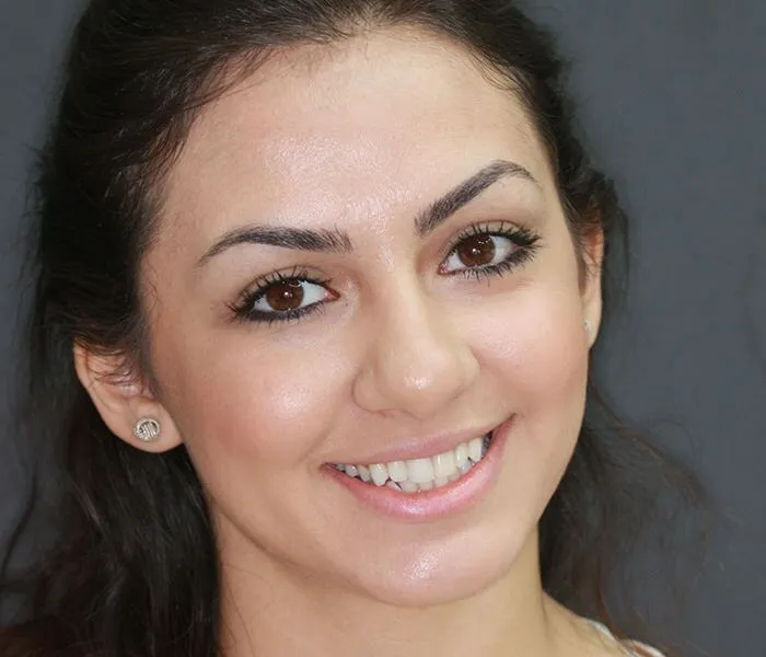 orthodontist-in-UAE
