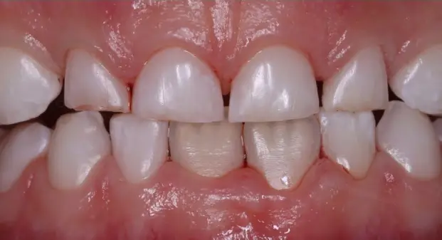 pediatric-dental-hospital-in-dubai