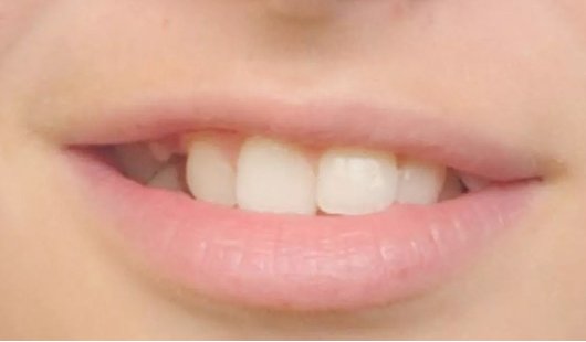 professional-orthodontic-treatment-in-dubai