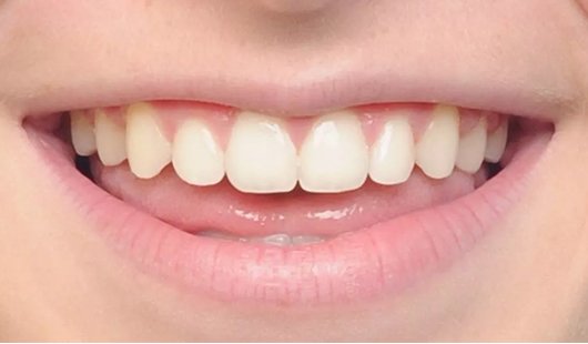 professional-orthodontic-treatment-in-dubai