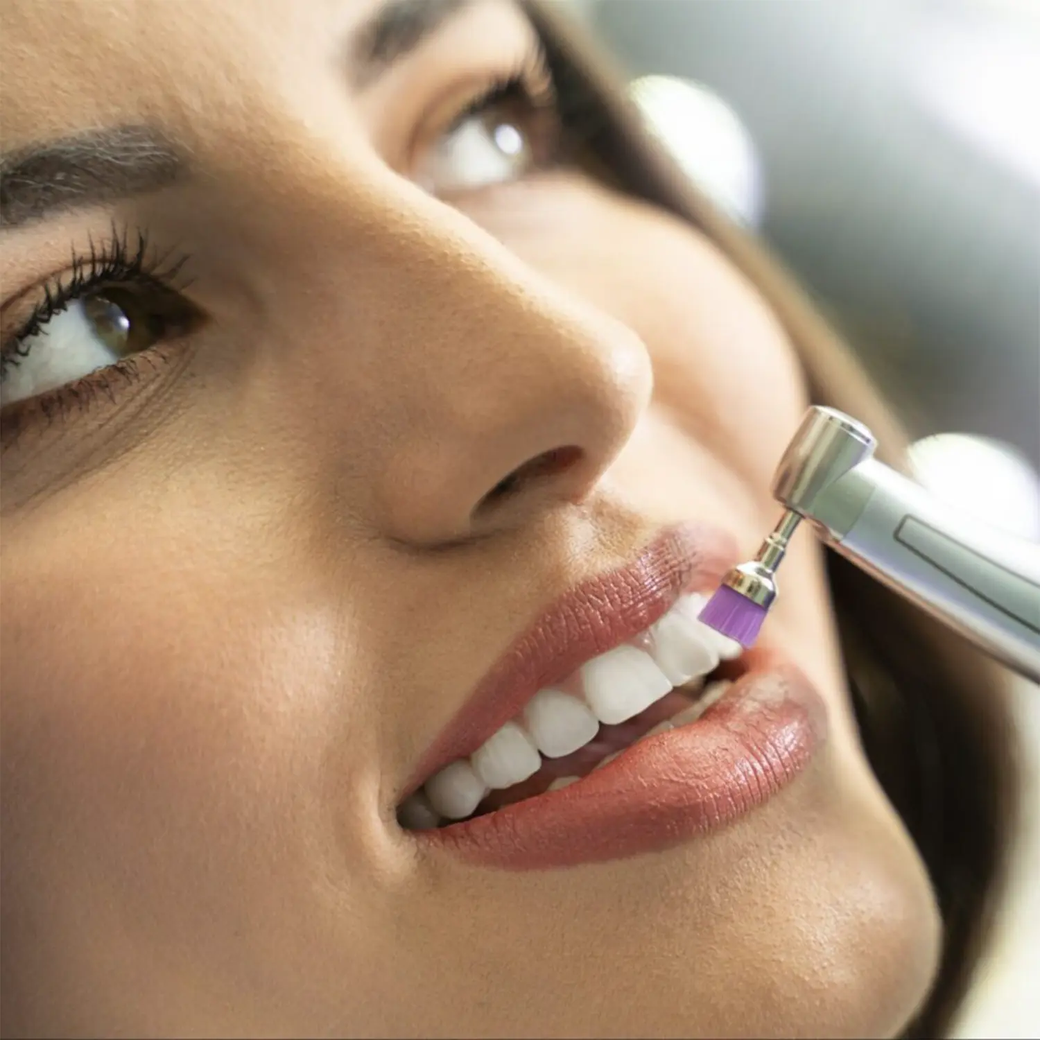 teeth-scaling-and-polishing-in-dubai