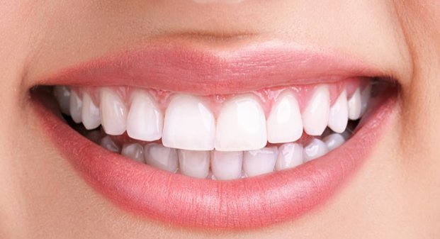 teeth-whitening-before-and-after-dubai