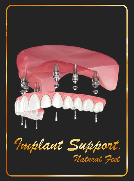 best-dental-clinic-for-implant-supported-dentures-cost-in-dubai