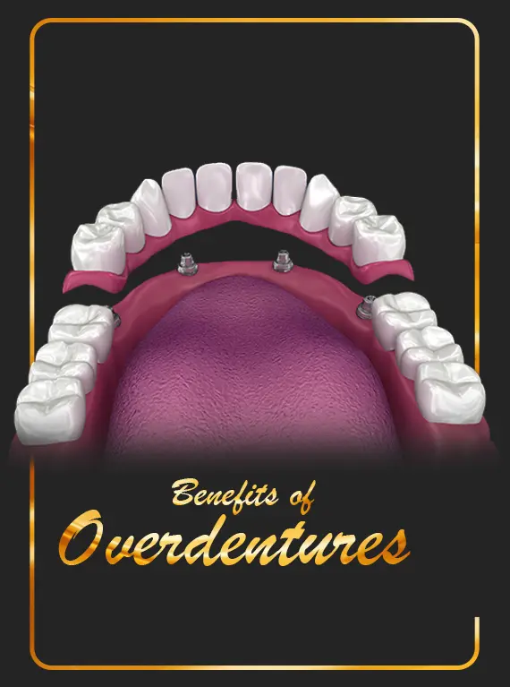 best-dental-clinic-for-overdentures-cost-in-dubai
