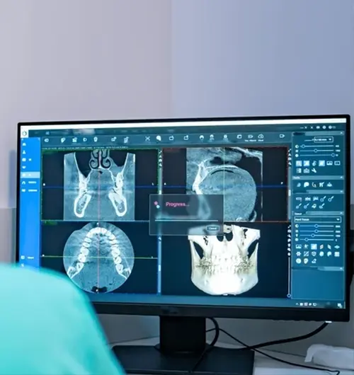 cbct-scan-in-dubai