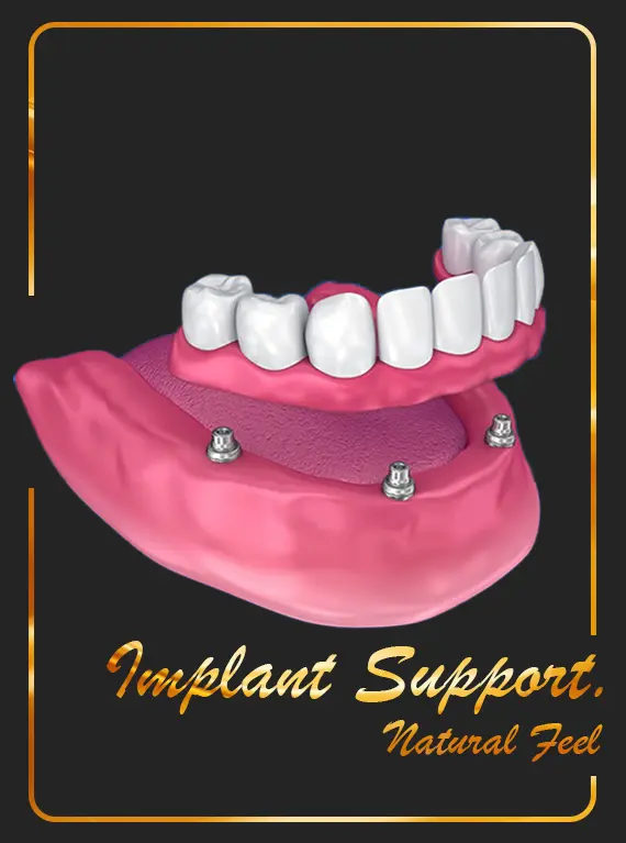custom-overdentures-cost-in-dubai