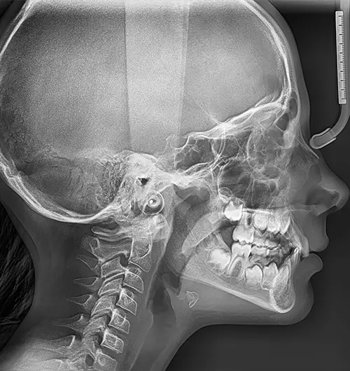 ditigal-dental-x-ray-in-dubai