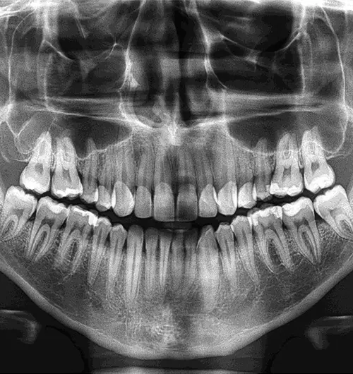 opg-x-ray-near-me