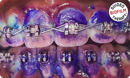 preventive-dental-care-in-dubai