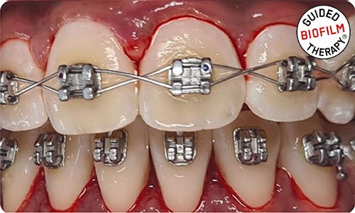 professional-dental-cleaning-dubai