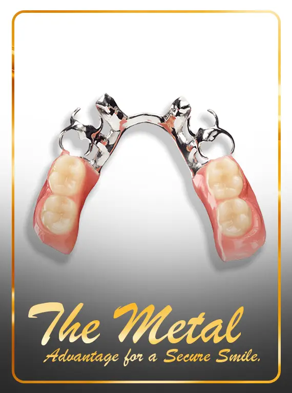 best-female-dentist-cast-partial-denture-treatment-in-dubai