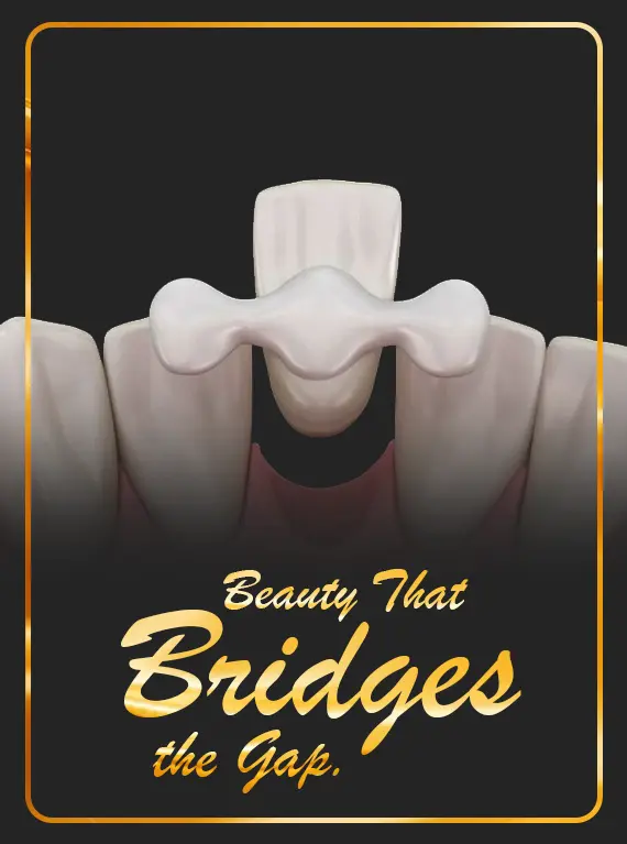 best-female-dentist-for-maryland-bridge-in-dubai