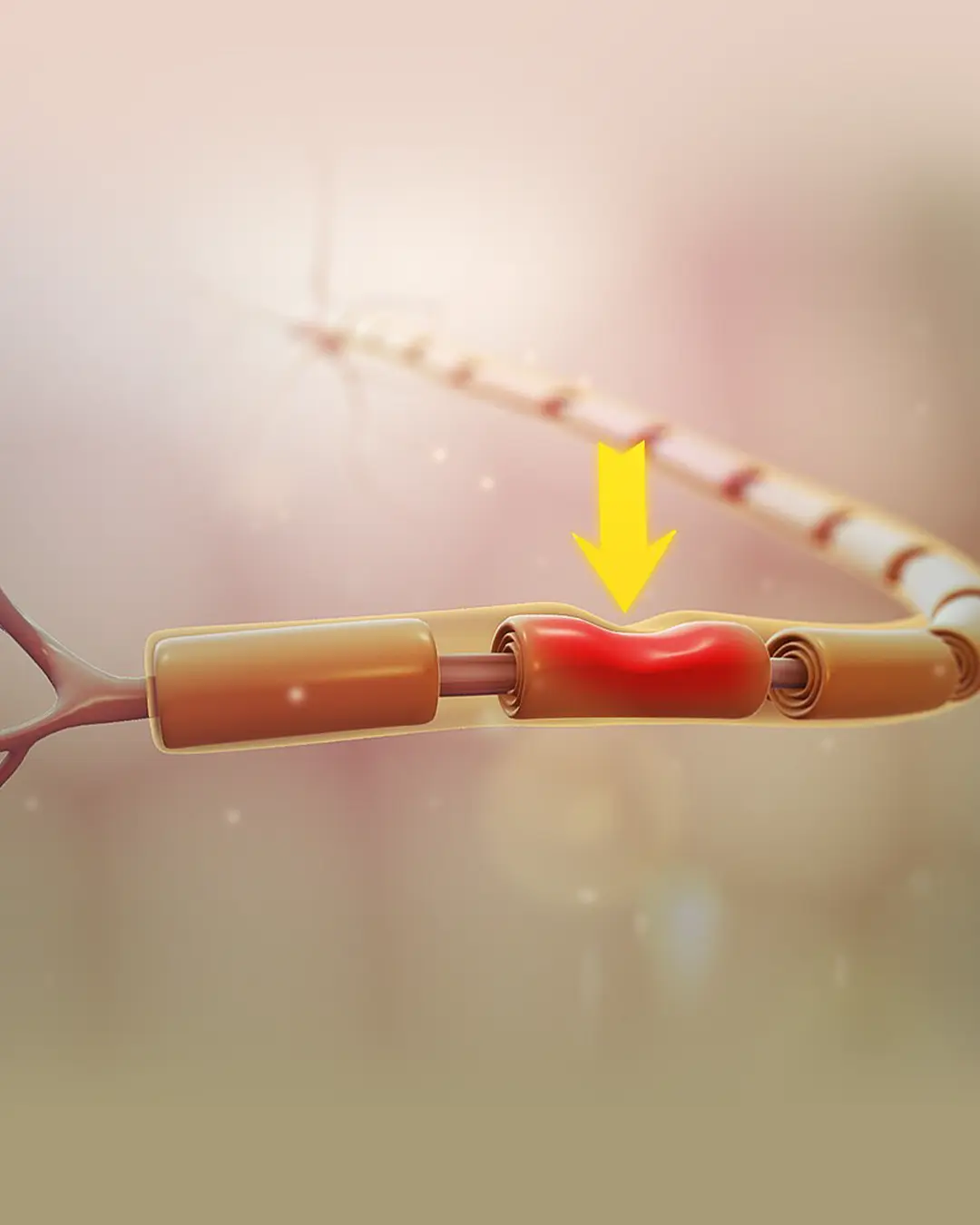 best-dental-clinic-for-laser-biostimulation-in-dubai