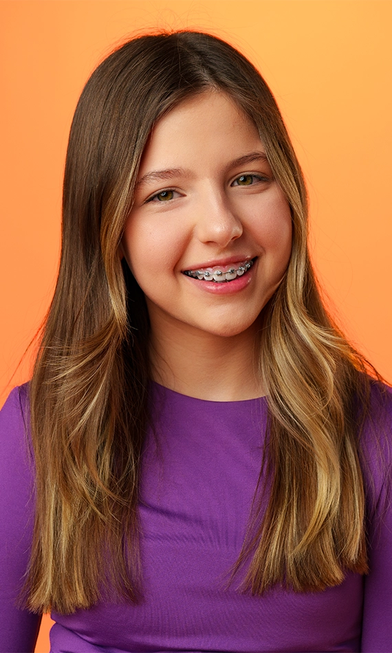 best-dental-clinic-for-metallic-braces-cost-in-dubai