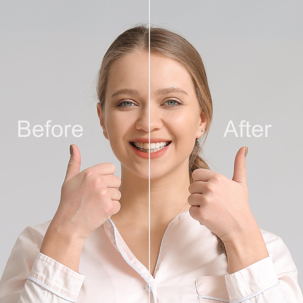 best-dental-clinic-for-smile-makeover-treatment-cost-in-dubai