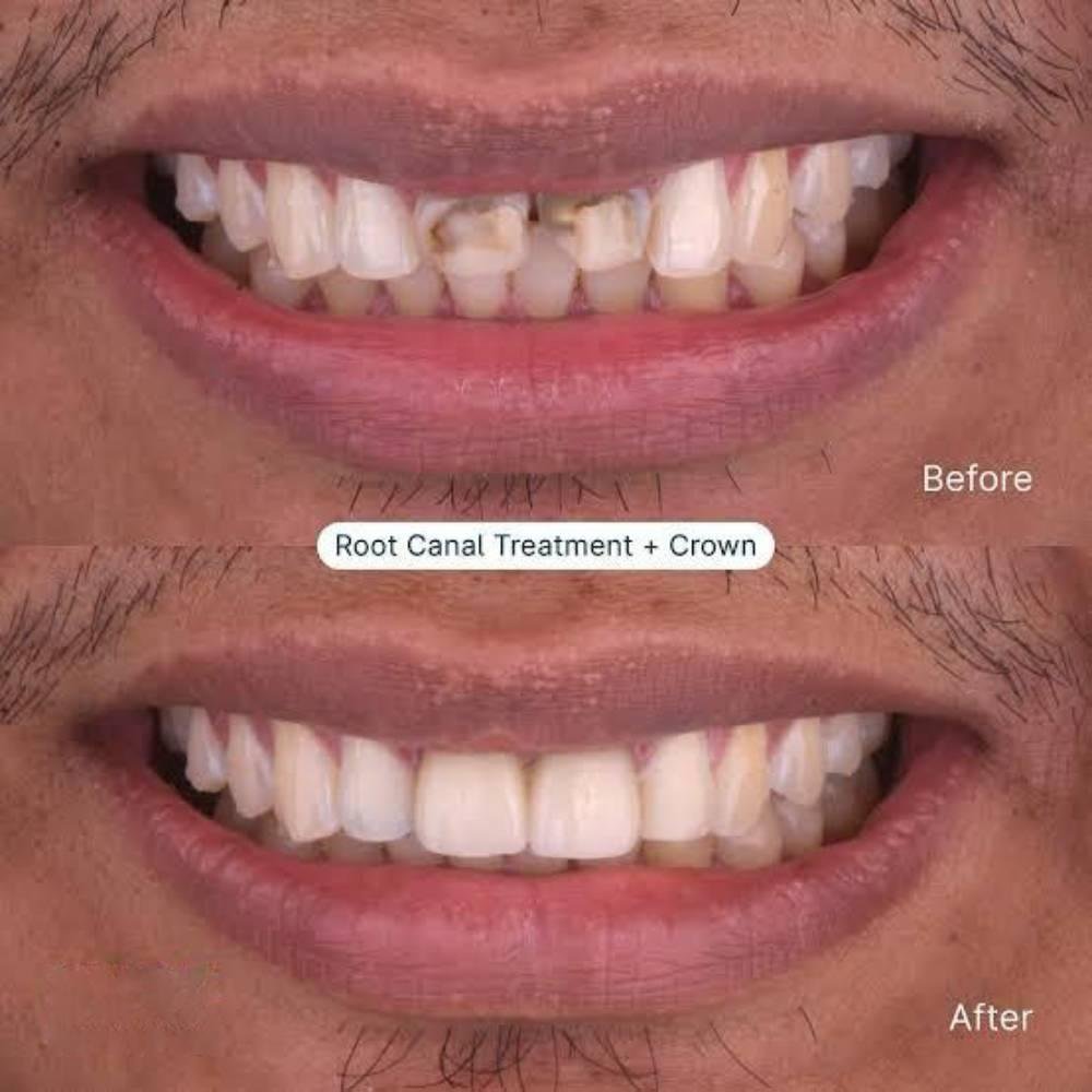 wmremove-transformed